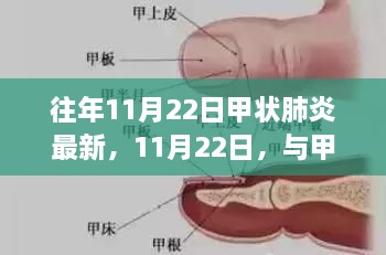 爱在冬日，与甲状肺炎的意外邂逅日常故事分享