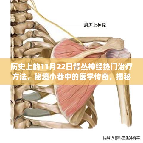 揭秘历史上的臂丛神经治疗秘籍，秘境小巷中的医学传奇与热门治疗方法回顾（11月22日篇）