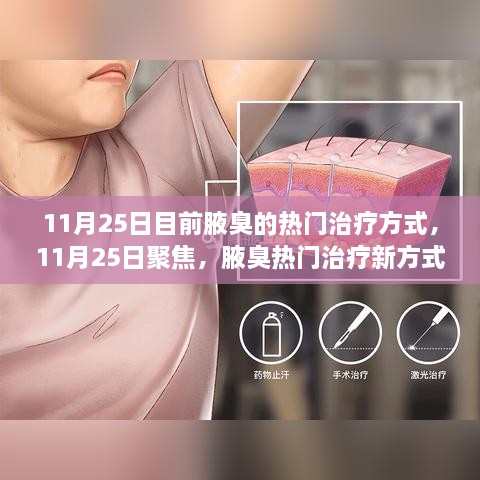 11月25日聚焦，腋臭热门治疗新方式