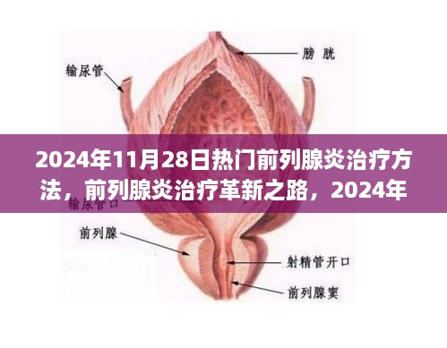 2024年前列腺炎治疗革新解析，热门疗法深度探讨